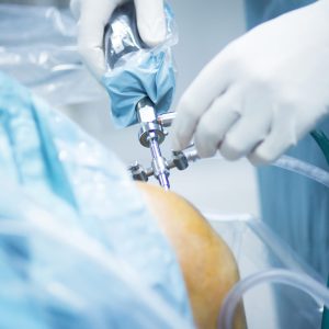 Arthroscopy & Minimally Invasive Surgery