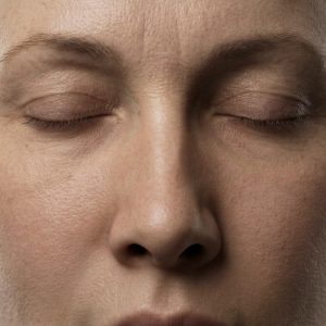 Facelift & Anti-Aging