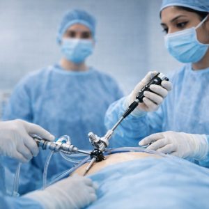 Laparoscopic