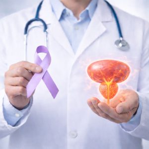 Prostate